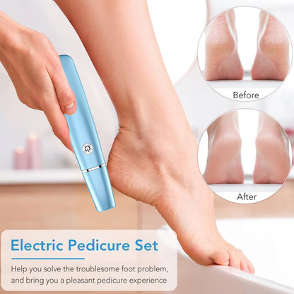 🎁Electric Foot Callus Remover