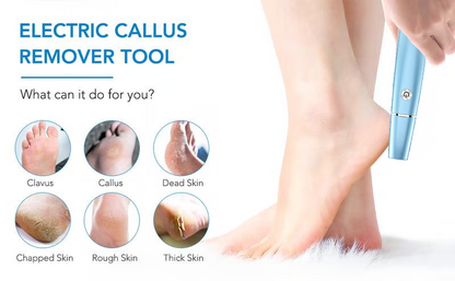 🎁Electric Foot Callus Remover