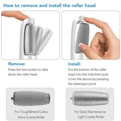 🎁Electric Foot Callus Remover