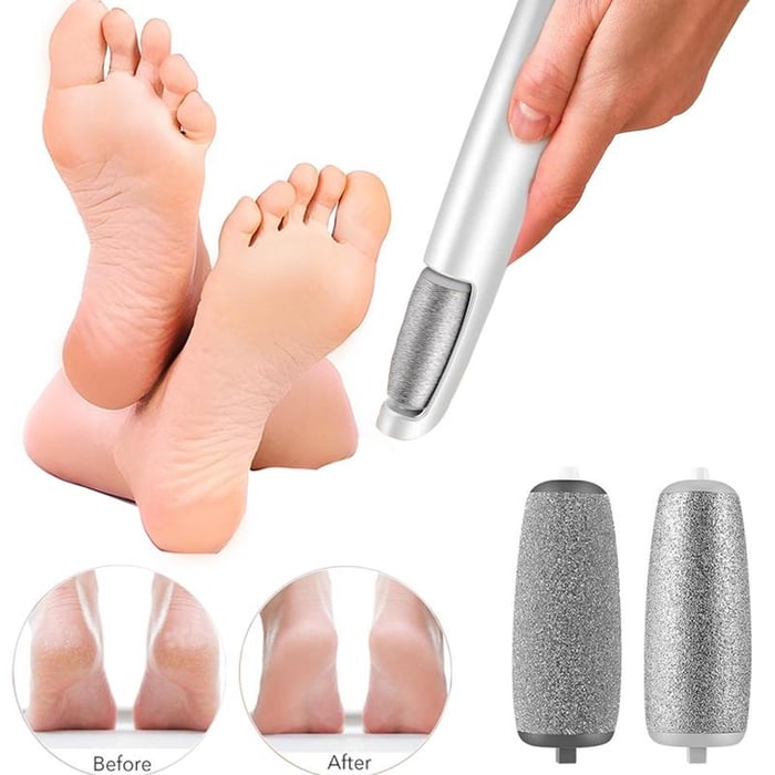 🎁Electric Foot Callus Remover