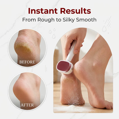 ✨📢LAST DAY SALE🔥Double-Sided Foot Scraper for Callus Removal