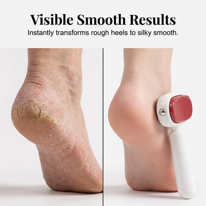 ✨📢LAST DAY SALE🔥Double-Sided Foot Scraper for Callus Removal