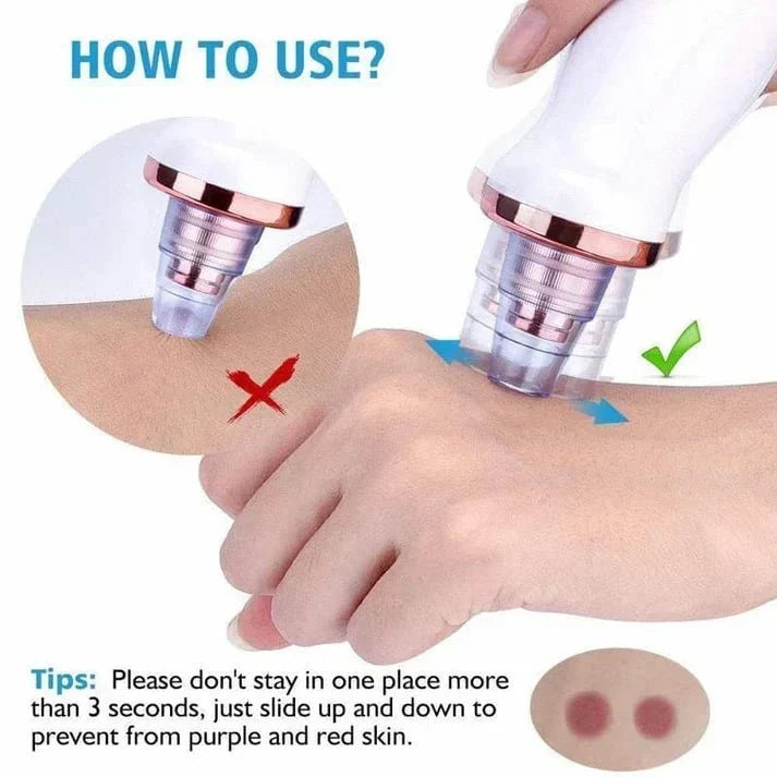 ✨Powerful Blackhead Removal Machine – Skin Care & Pore Cleaner